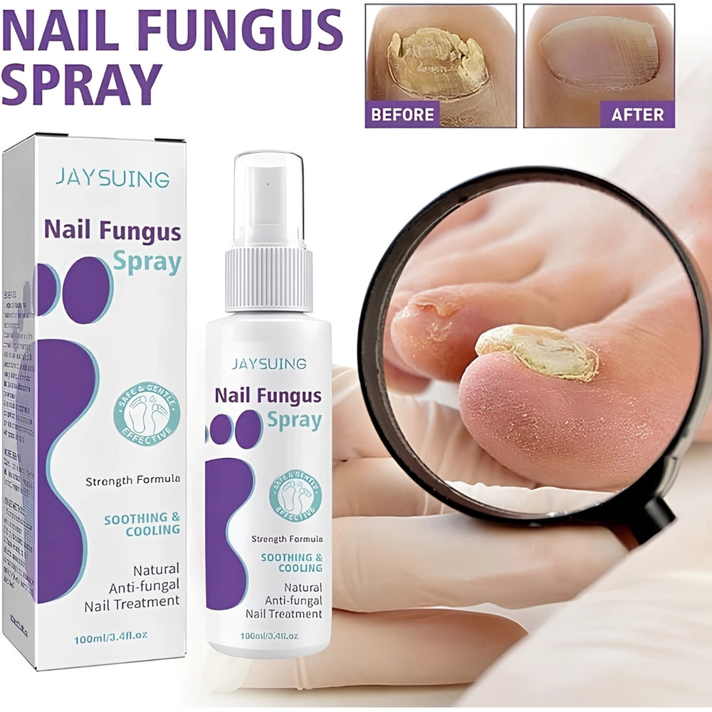 Nail Fungus Treatment Spray