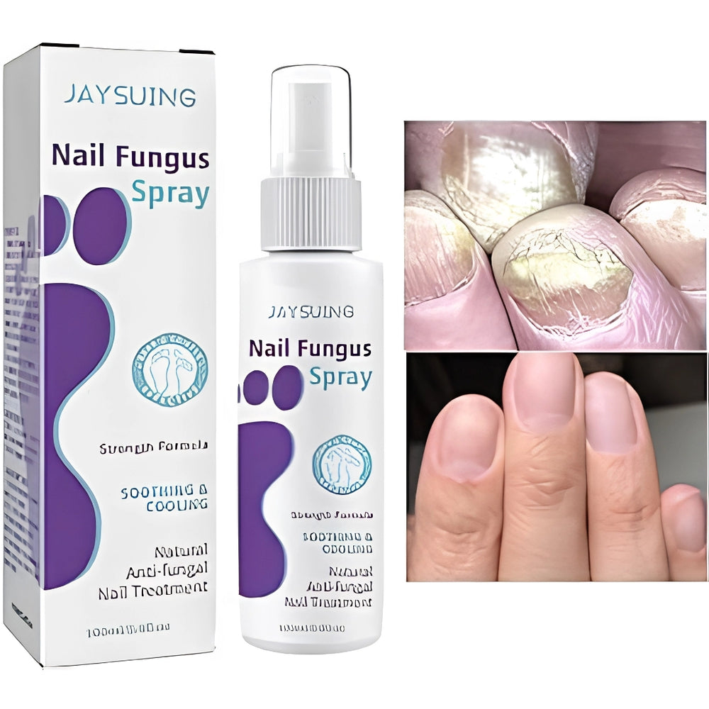 Nail Fungus Treatment Spray