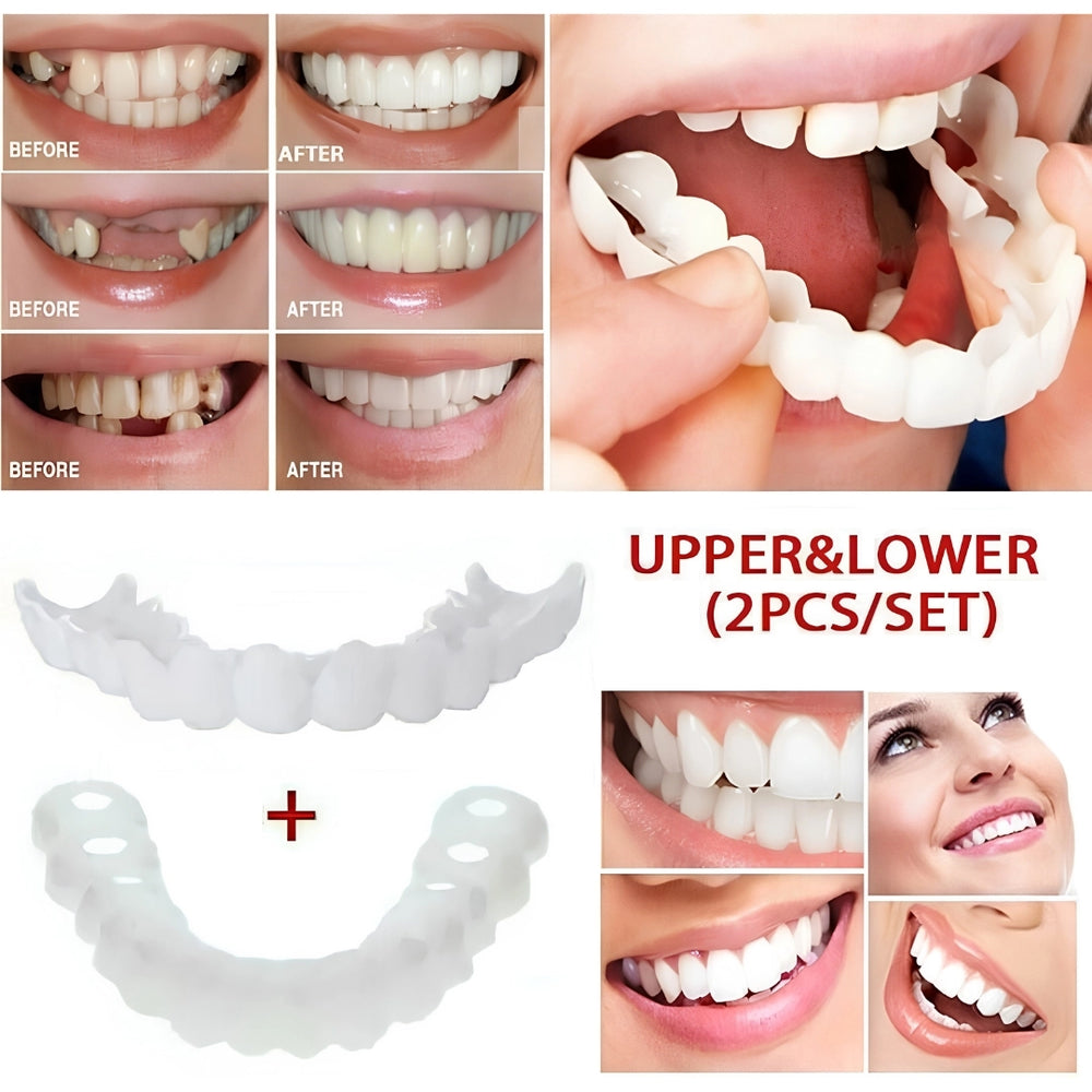 Snap-In Cosmetic Teeth